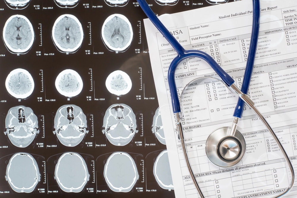 medical record retrieval
